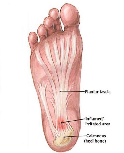 stabbing pain in arch of foot
