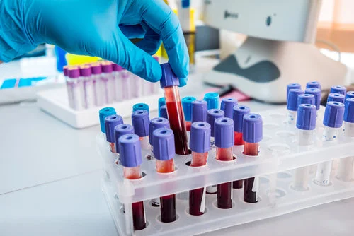 Laboruntersuchungen Die moderne Labormedizin kann hervorragend zur individuellen Vorsorge eingesetzt werden. Die Möglichkeiten gehen weit über die Kassenvorsorge hinaus. Ganz nach Ihrem Sicherheitsbedürfnis lassen sich so gezielt Ihre Risiken ausschließen …
