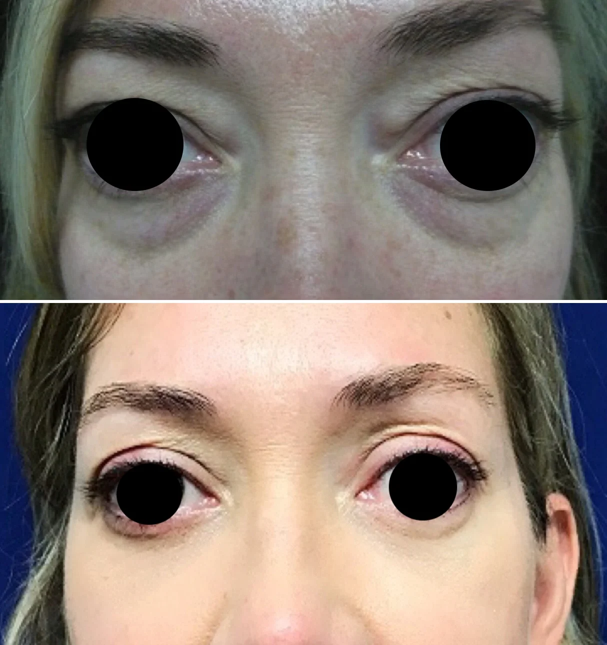 eyes_edited_1.jpg