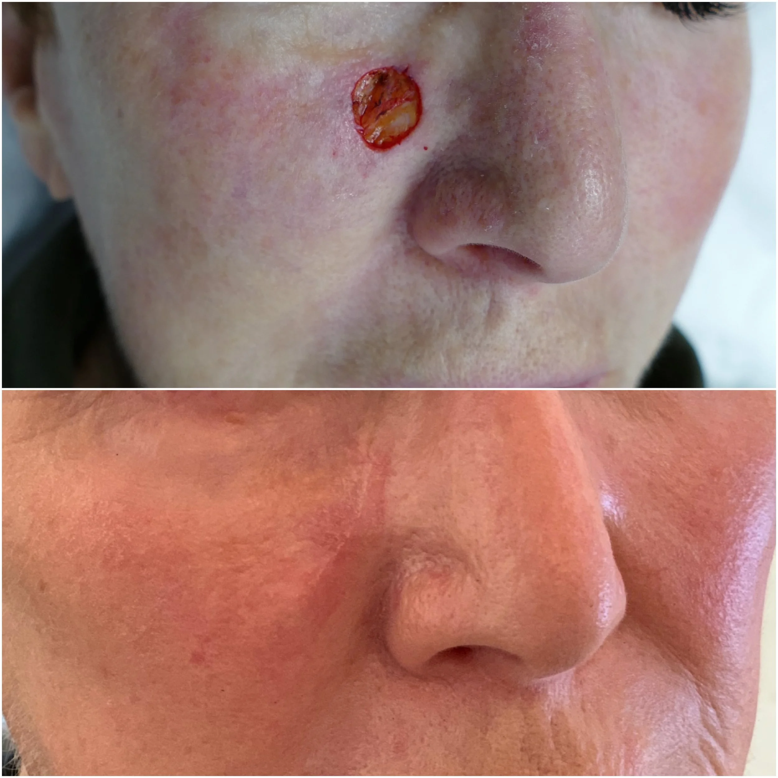 MOHS_CLOSURE_5.jpg