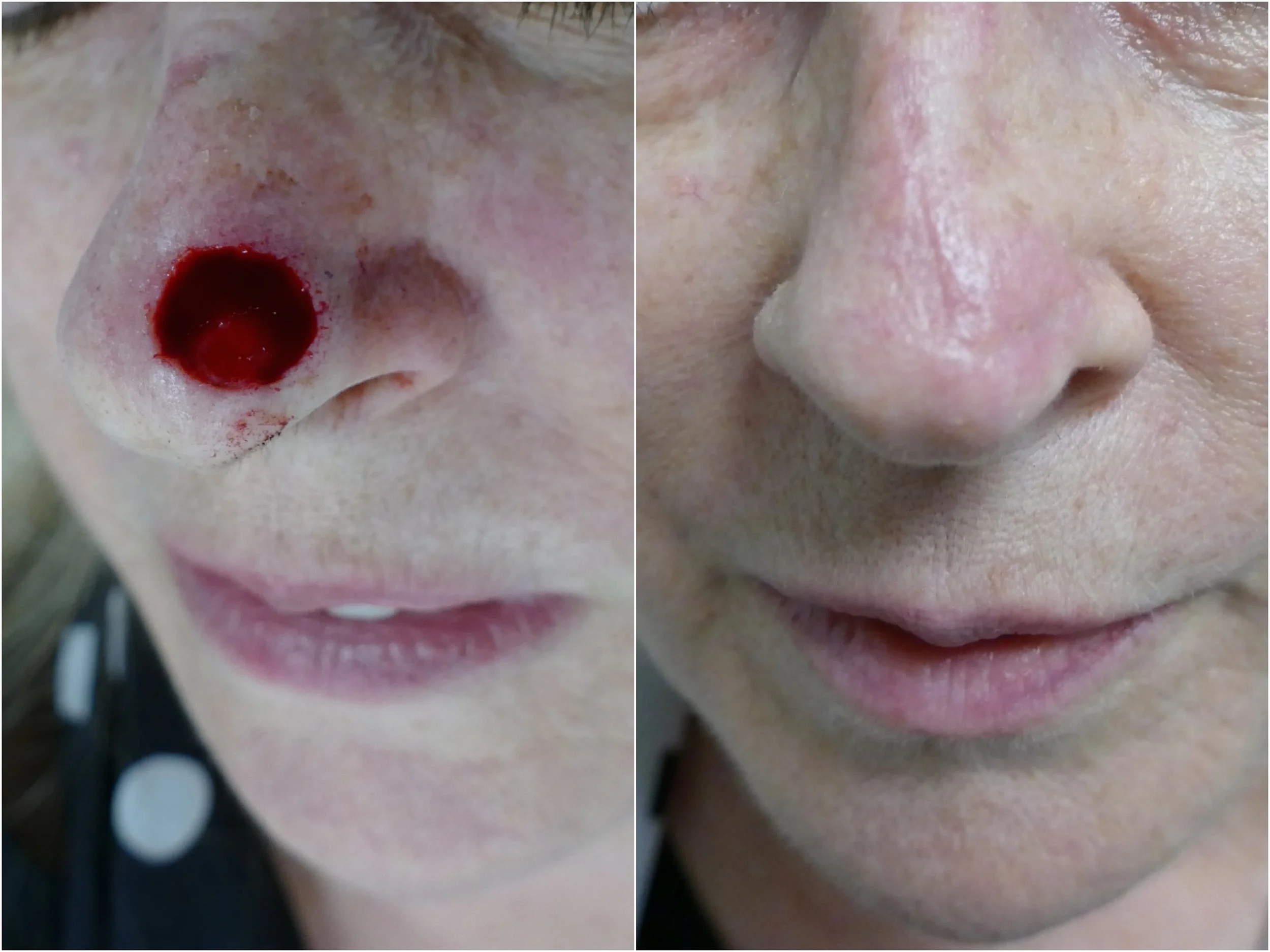 MOHS_closure_4.jpg