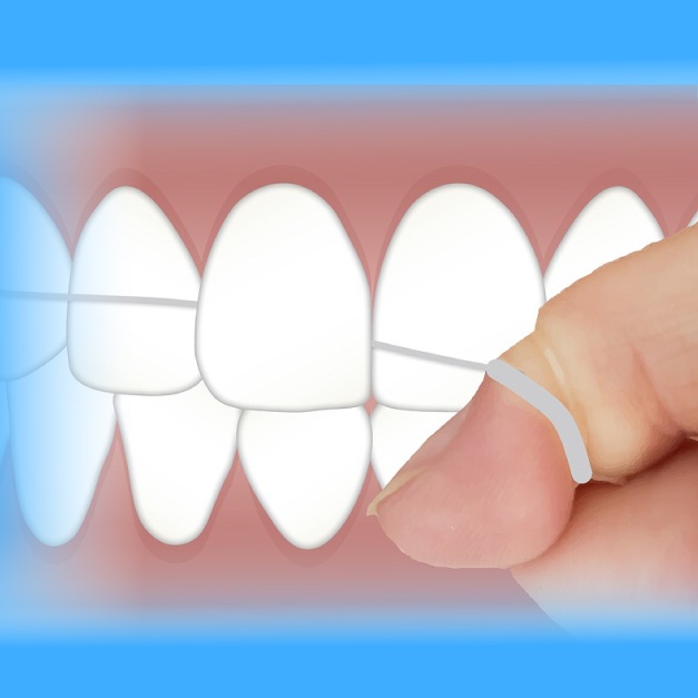 Flossing illustration of string in between teeth removing debris to clean the mouth and prevent tooth decay