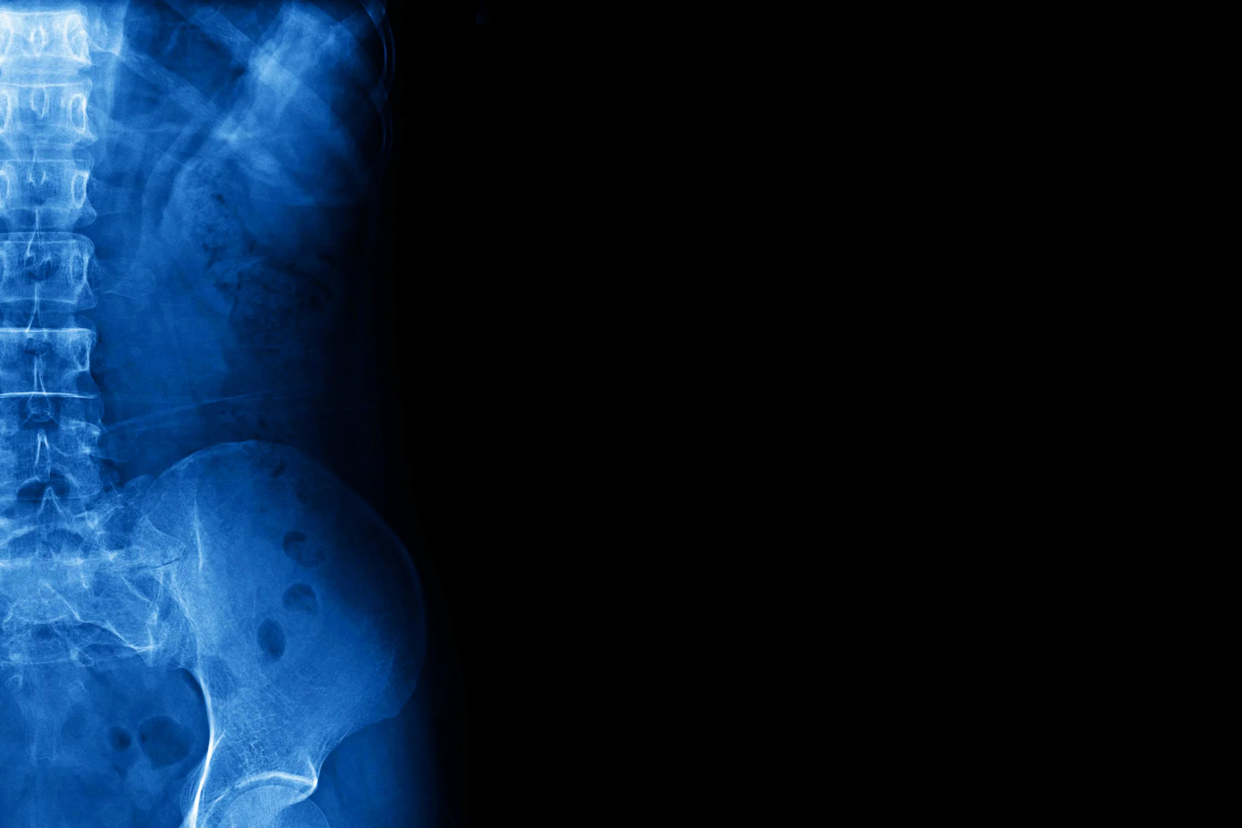 pelvis blue.jpg