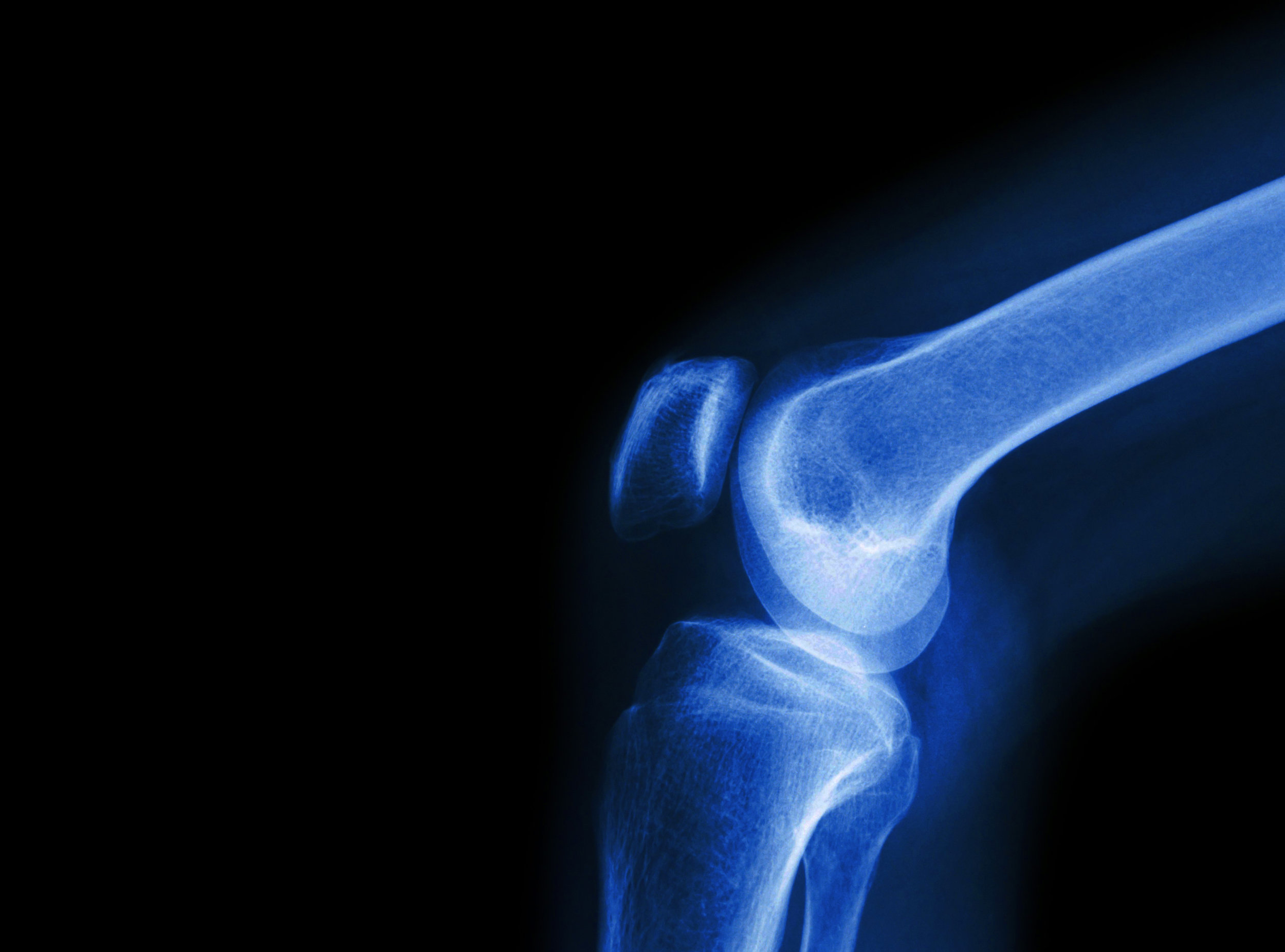 knee.jpg