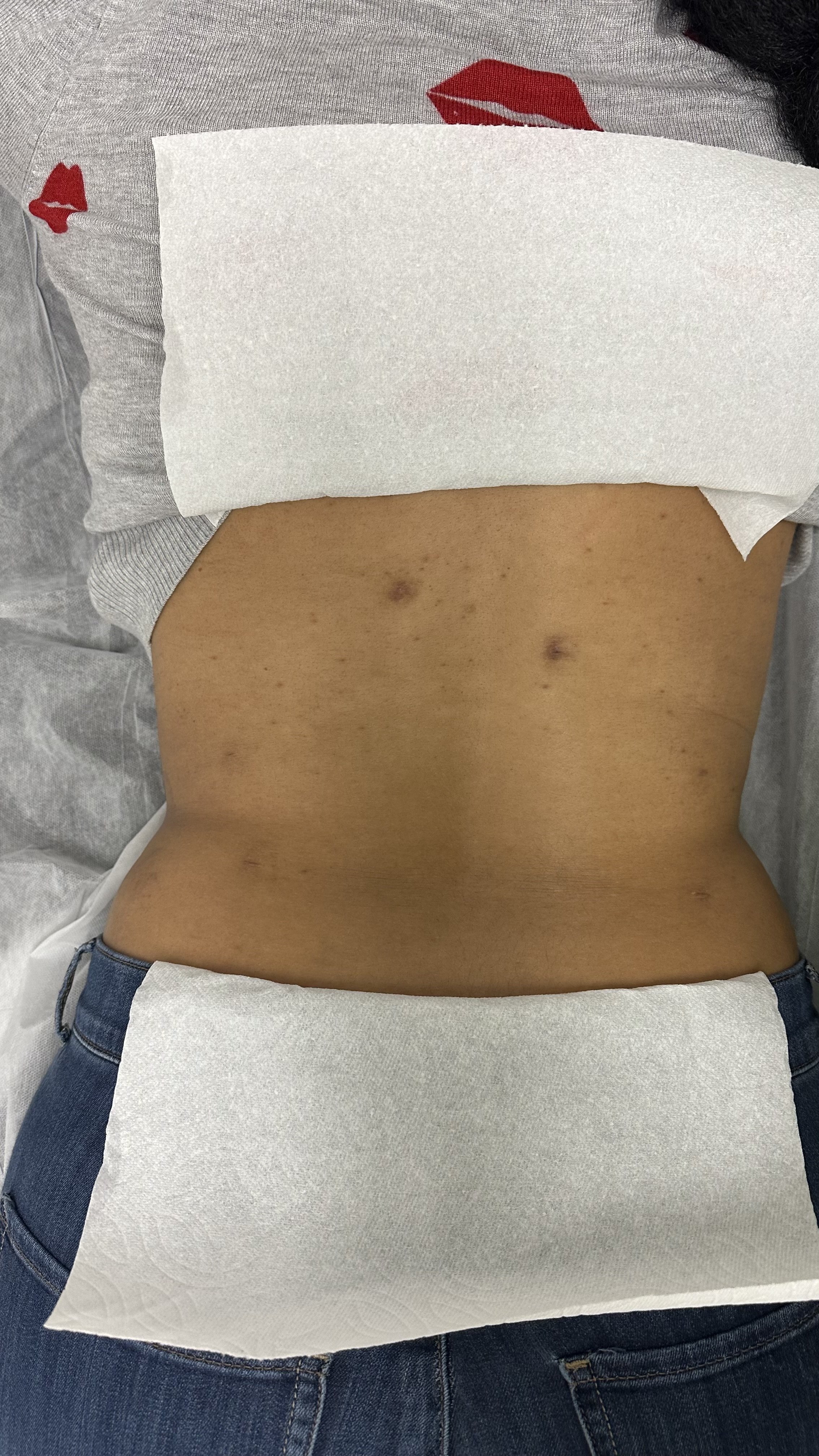 Stretch Marks Camouflage — Dariana Garcia