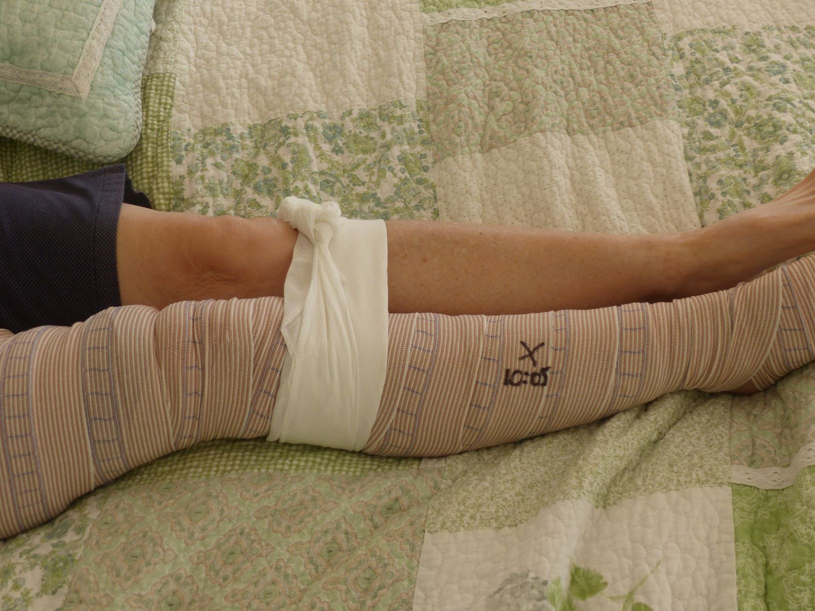 splint_leg.JPG