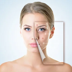 Reviderm Gesichtsbehandlung