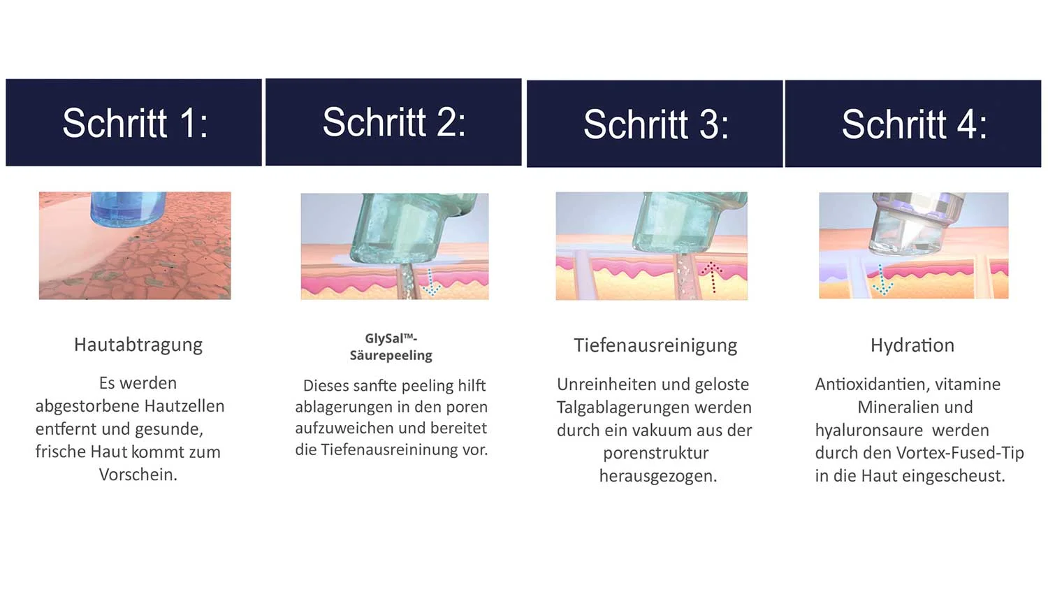 Hydrafacial-Verfahren-Frankfurt.jpg