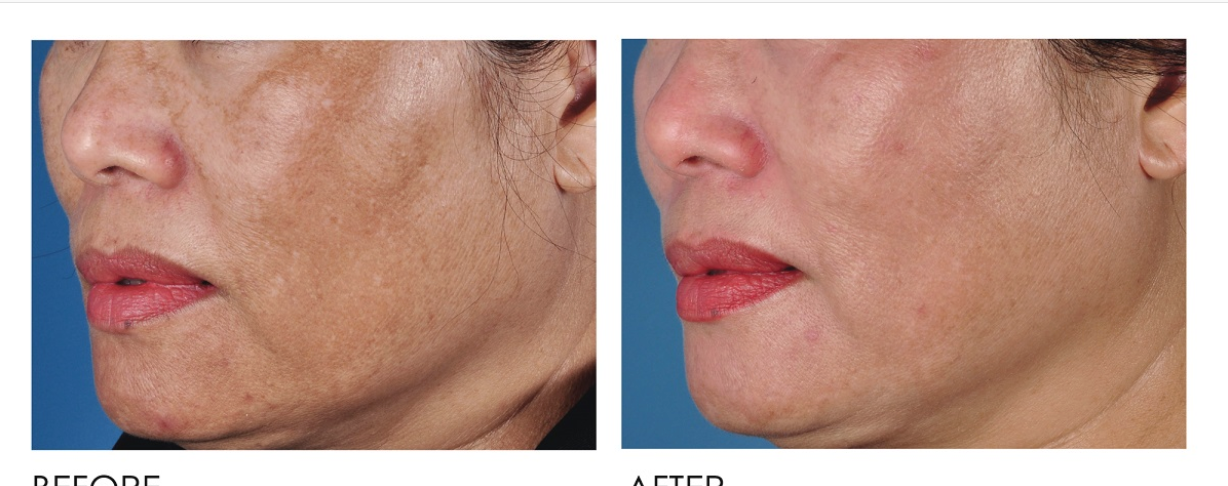 CustomizedSkinCare_Detail_01.png