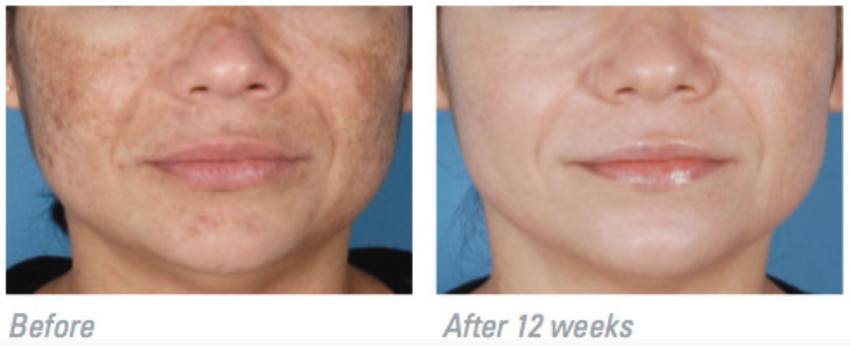CustomizedSkinCare_Detail_02.png