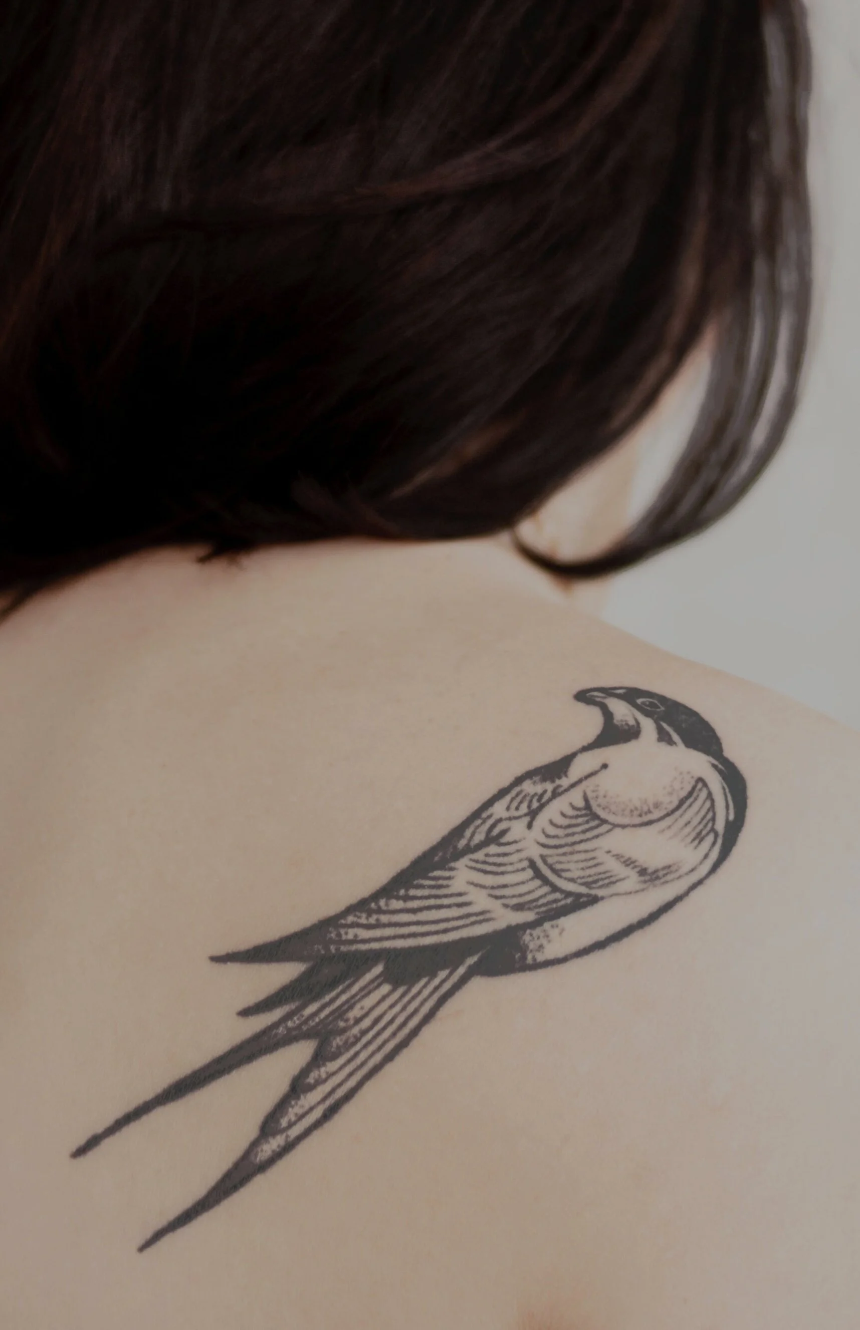 LASER TATTOO REMOVAL