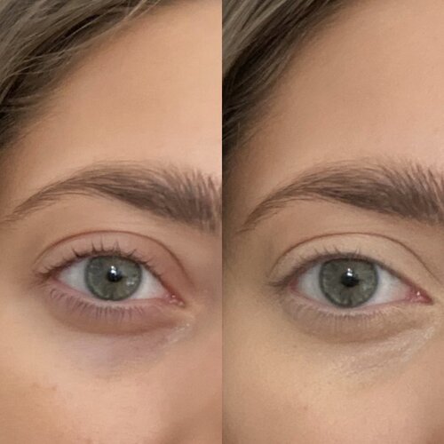 L'Oréal Match Eye Cream In A Concealer — A Broke Blogger