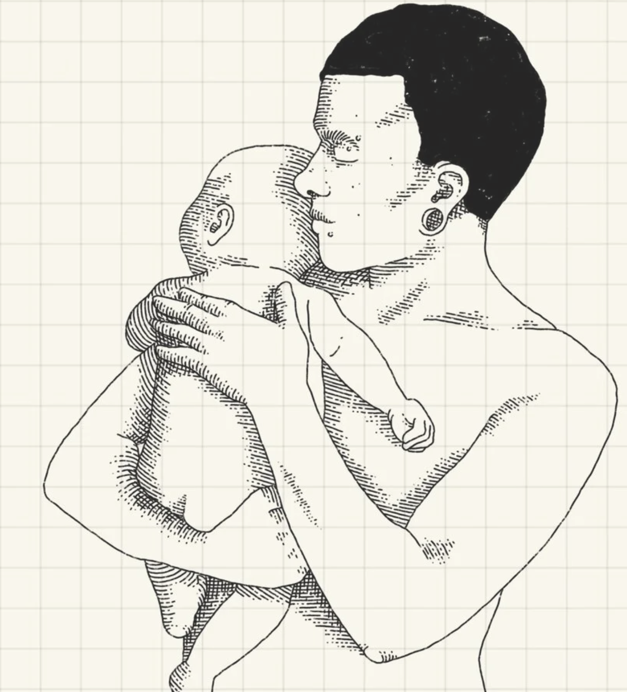 Top Surgery and Lactation: What Do We Know?