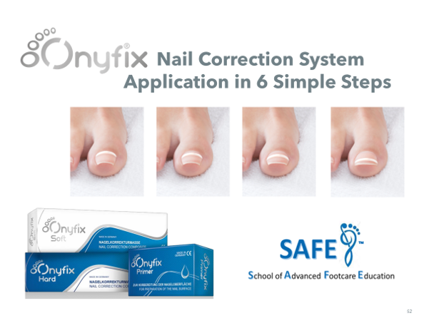 SAFE ONLINE Onyfix "FREE" Workshop with Live Demonstration  Monday August 10th 11:am-1 pm Eastern Time 