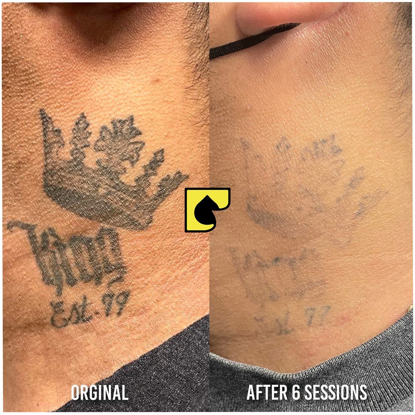 We make it easy to erase your past. The year is nearing to the end which makes it a perfect time for a new beginning
Call us on ☎️ (562) 861-9400 or contact us through our website by clicking the link in our bio 👈

*All results may vary per individu