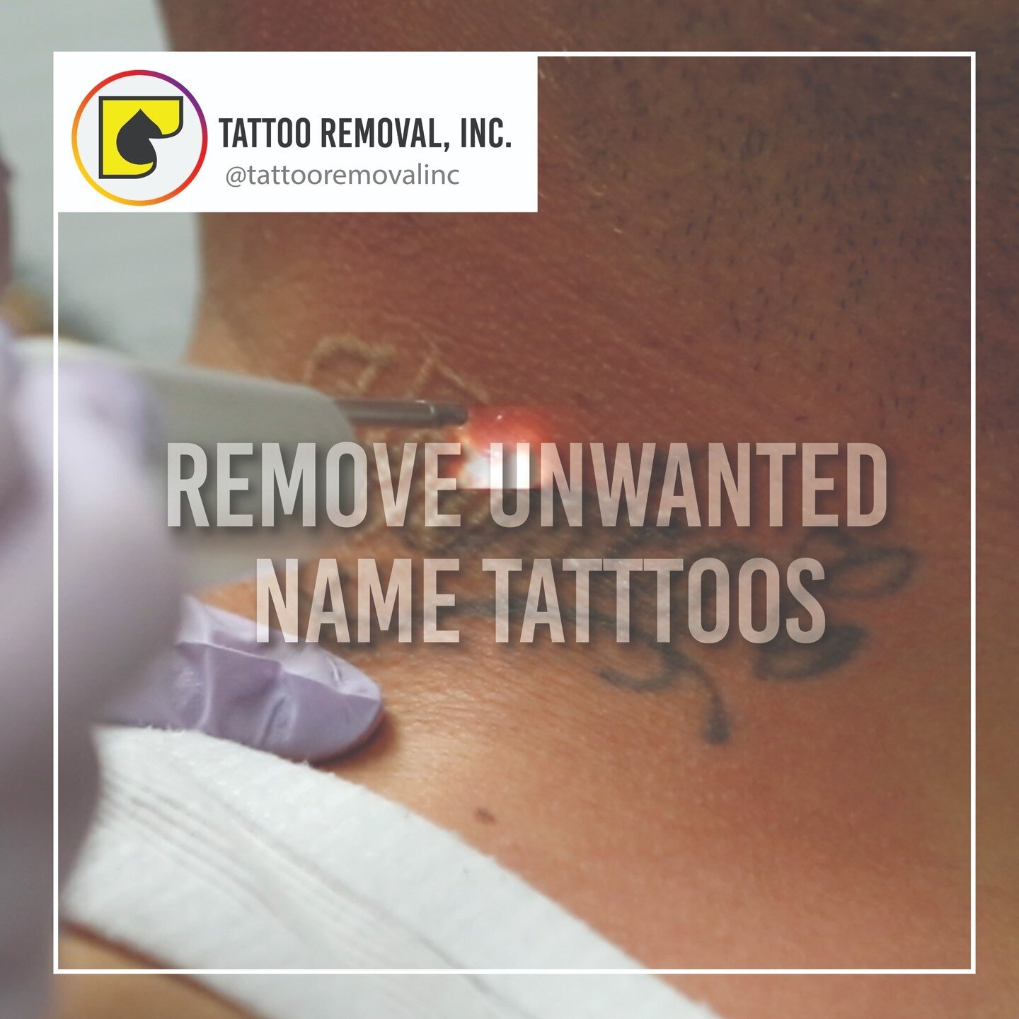 Removers of the unwanted. Have anything you want to completely remove or just fade enough for a cover up?
Call us today ☎️ (562) 861-9400 📞 and schedule a free consultation!!

*All results may vary per individual and photos are unfiltered
#ResultsMa