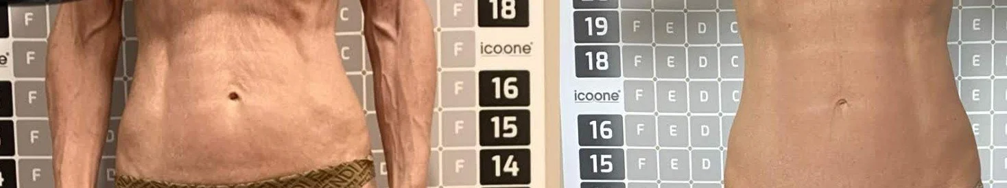 cropped abdomen tightening.jpg