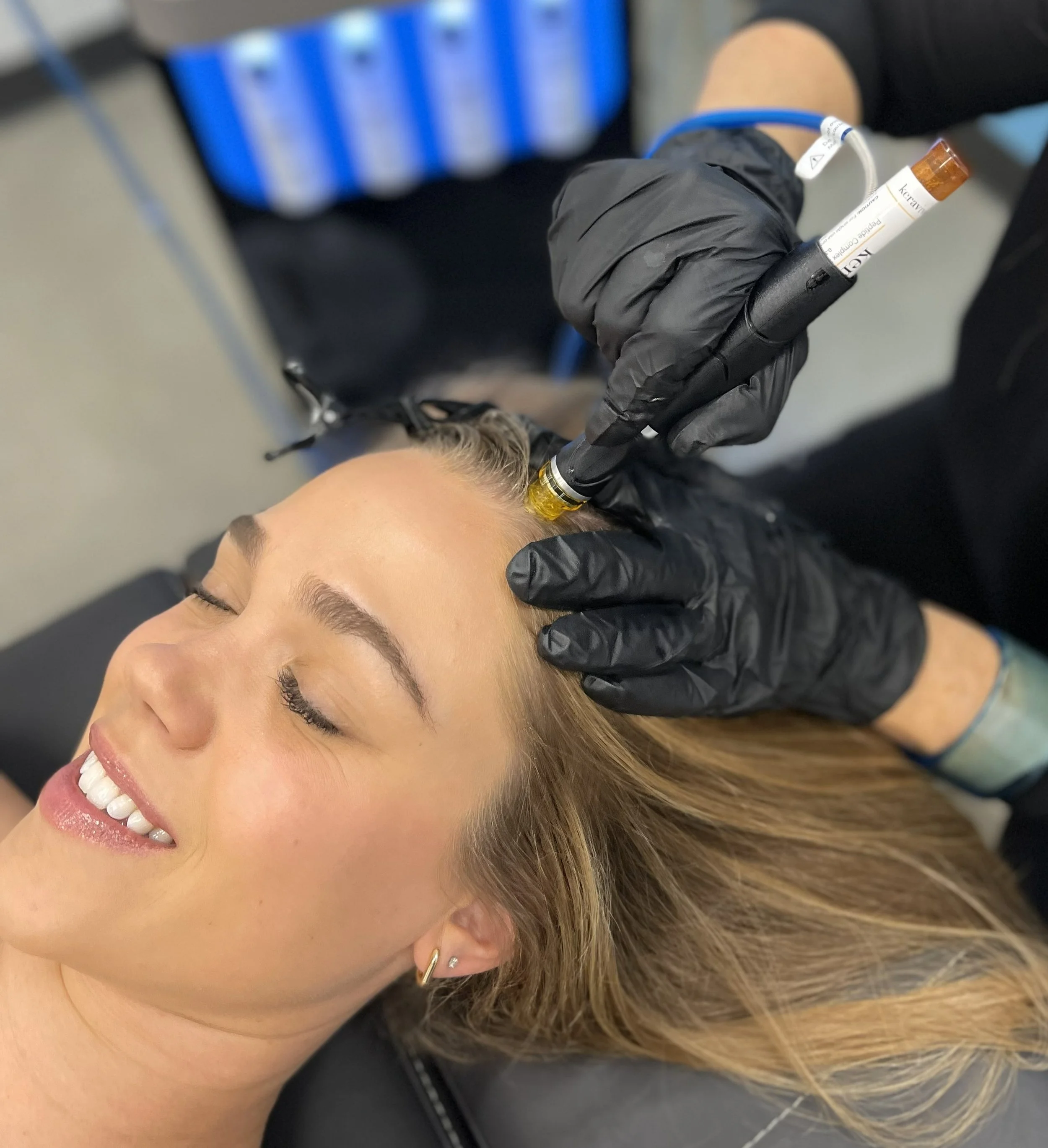 Scalp Cleaning, Oxygenation and Rejuvenation at Revive Skin and Body Care Center