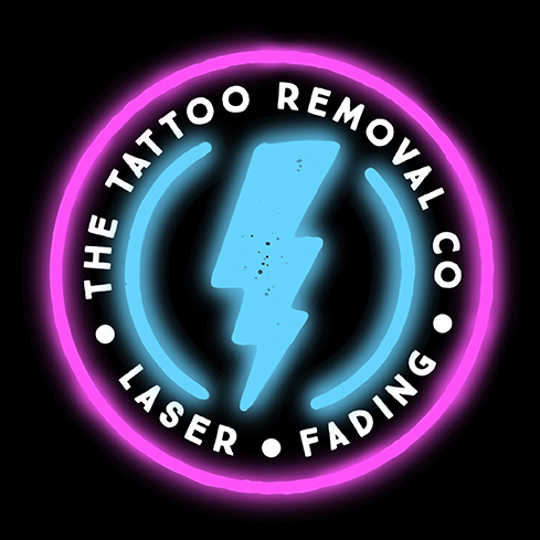 The Tattoo Removal Co - Laser Tattoo Removal — Stu Pagdin Tattooer