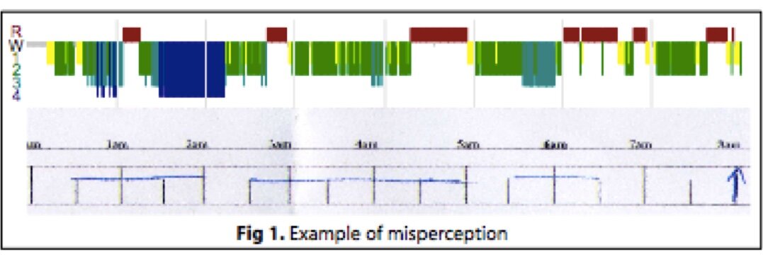 The top coloured graph is a polysomnogram, where the colours show different stages of sleep, and they grey parts (eg, the very start of the night) show when they were awake). The bottom figure is the insomnia patient’s sleep diary for that night (blue horizontal lines indicate when they perceived they were asleep, and gaps indicate when they thought they were awake.