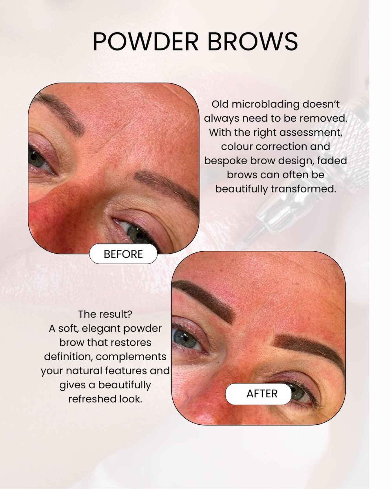 Remarkable transformation by Cristina today at @lash_envy__ ✨

Her client&rsquo;s 2023 microblading had experienced colour shift and patchy fading over time, leaving her feeling self conscious and frustrated with having to fill in her brows every day