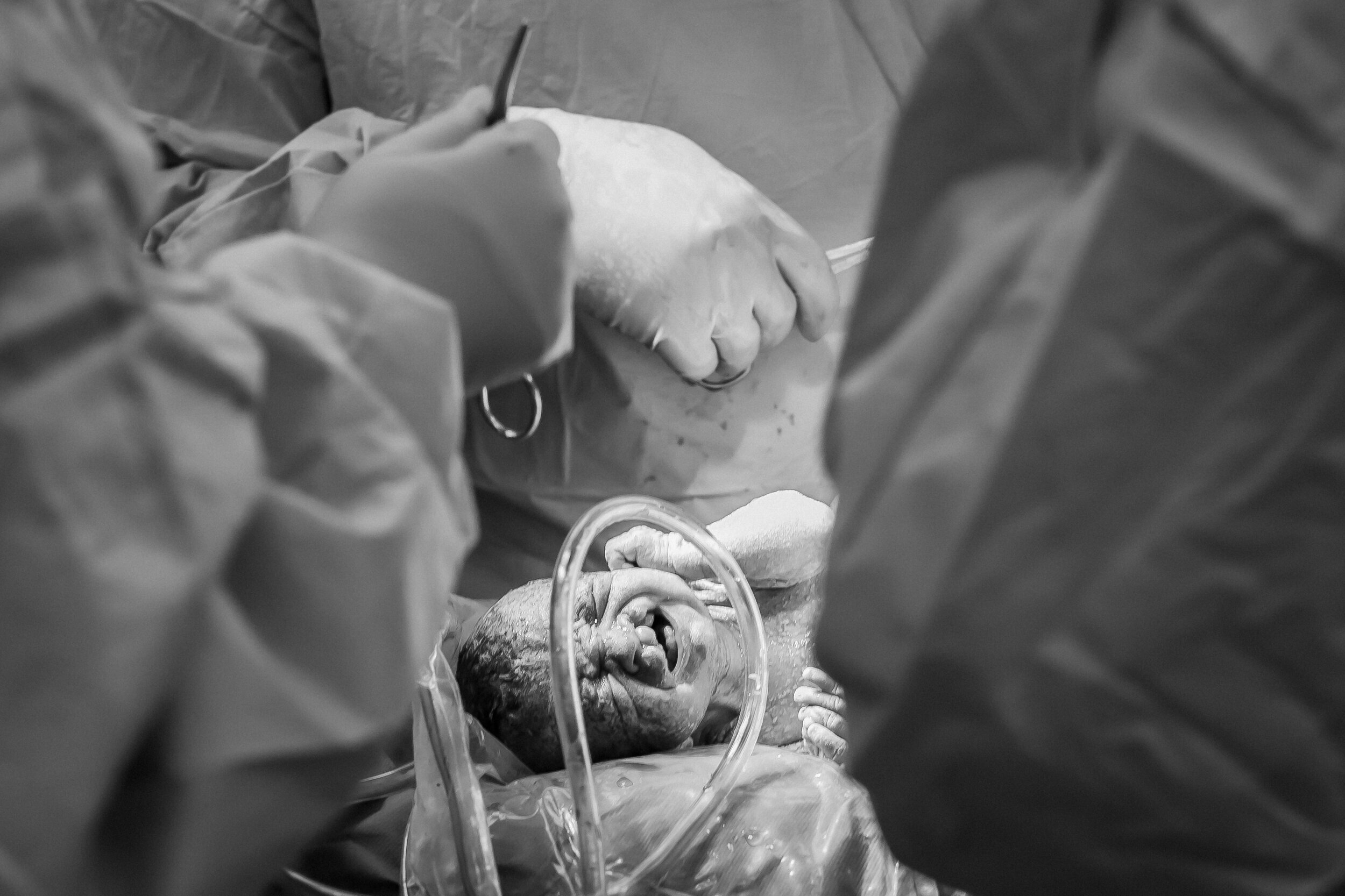 Baby Born Cesarean Section