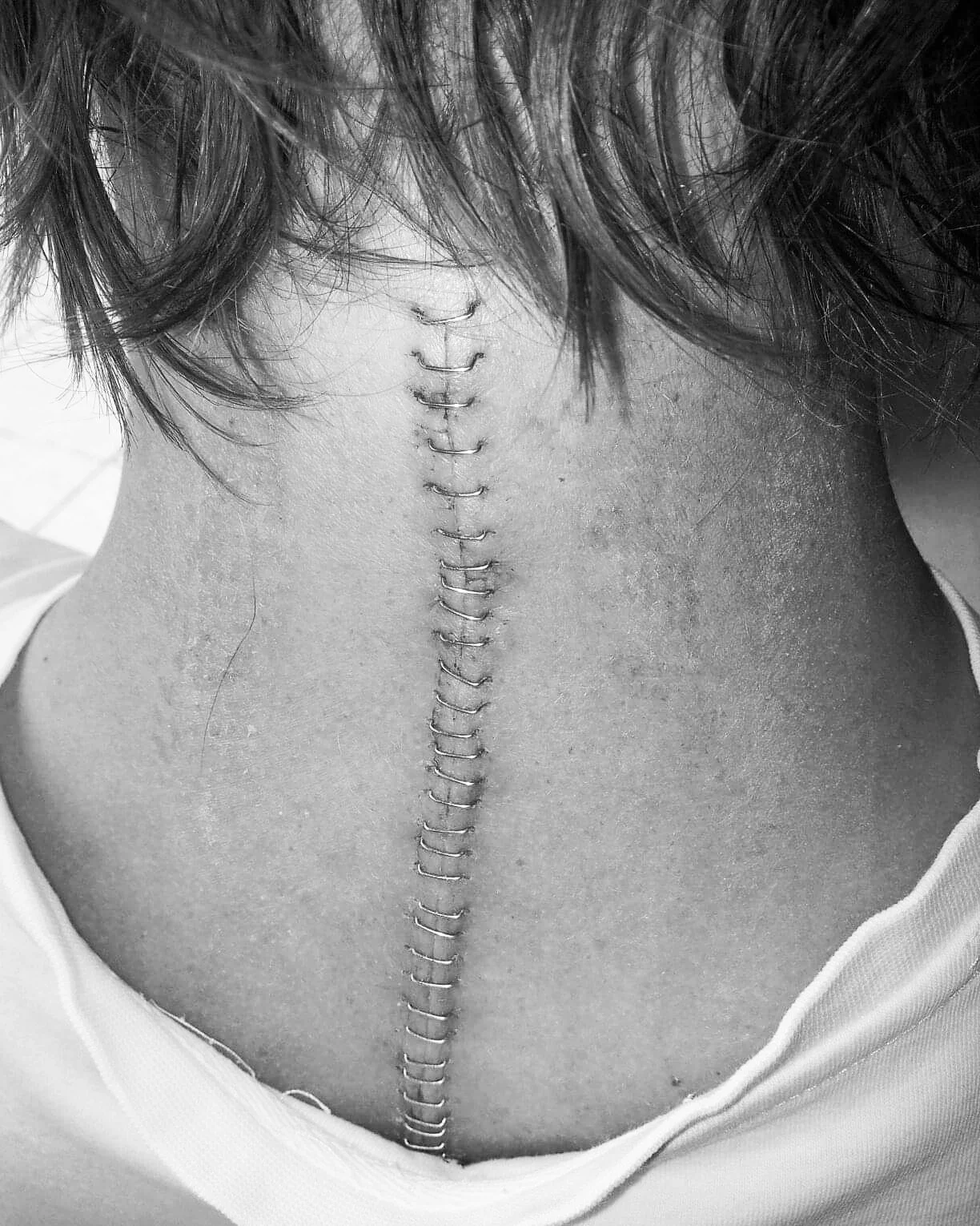 I Don’t Sit Around Reminiscing About Walking