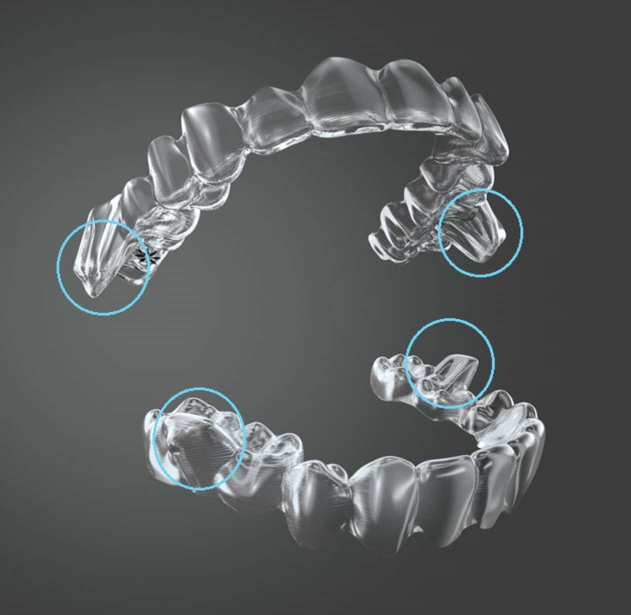 Dentist vs. DIY Clear Aligners – buyer beware