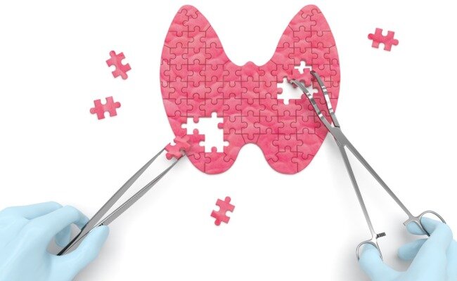 Thyroid Treatment with Chinese Medicine episode artwork