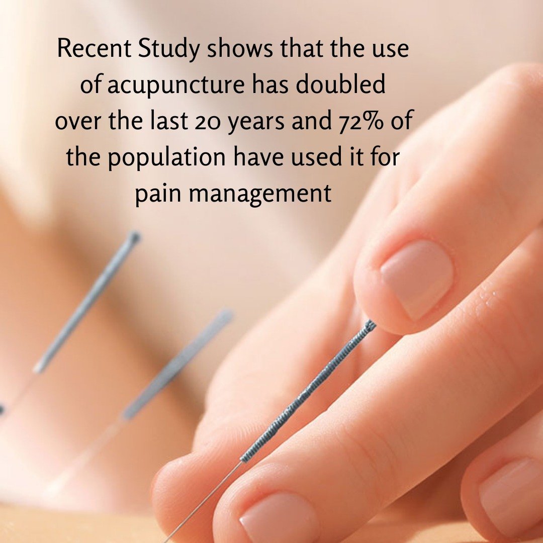 A recent study conducted in the United States has shown that the use of acupuncture in the previous 12 months increased from 1% of adults in 2002 to 1.5% in 2012 to 2.2% in 2022. That equates to over 7.3 million adult patients.
Use of acupuncture for