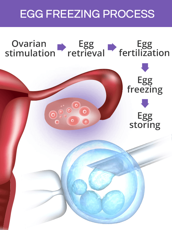 Optimising Egg Freezing