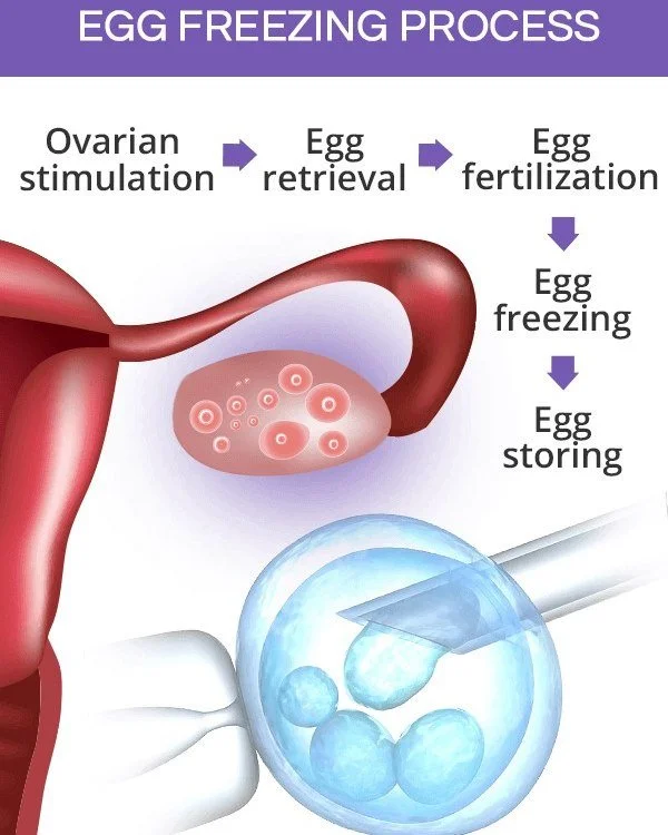 More women today are thinking about fertility preservation earlier in life. Many are in their early or mid-30s, building careers, pursuing advanced education, or simply waiting to meet the right partner. These are all thoughtful and valid reasons to 