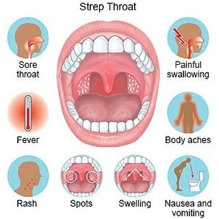 Sore throat that won&rsquo;t go away? It could be strep! 🤒

Strep throat is a bacterial infection that causes sudden sore throat, pain when swallowing, fever, and swollen tonsils &mdash; sometimes with white patches or tiny red spots. It spreads eas
