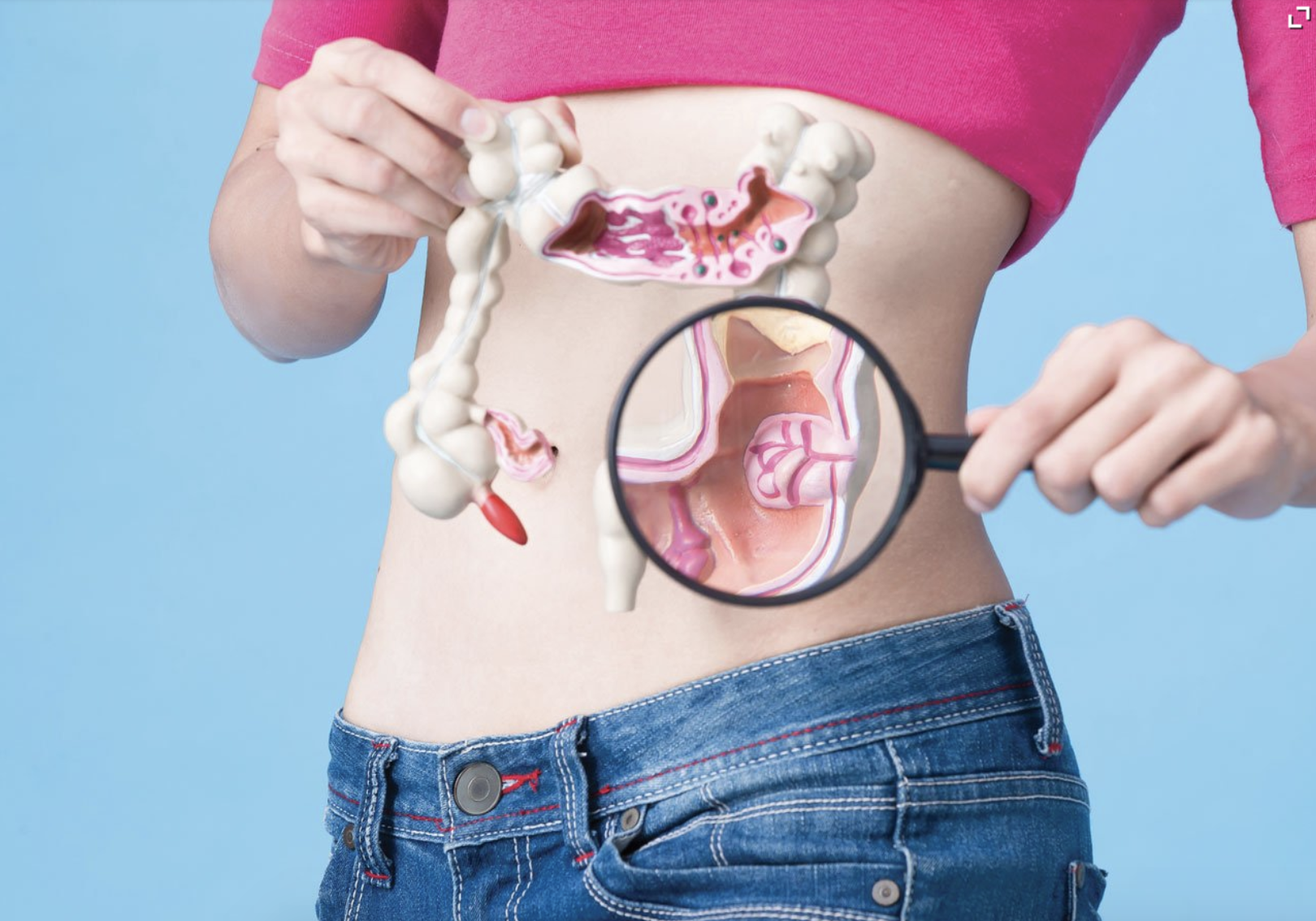 Colon Cancer.png