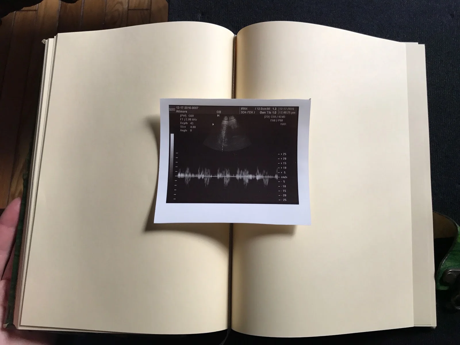 When Miscarriage Entered Our Marriage