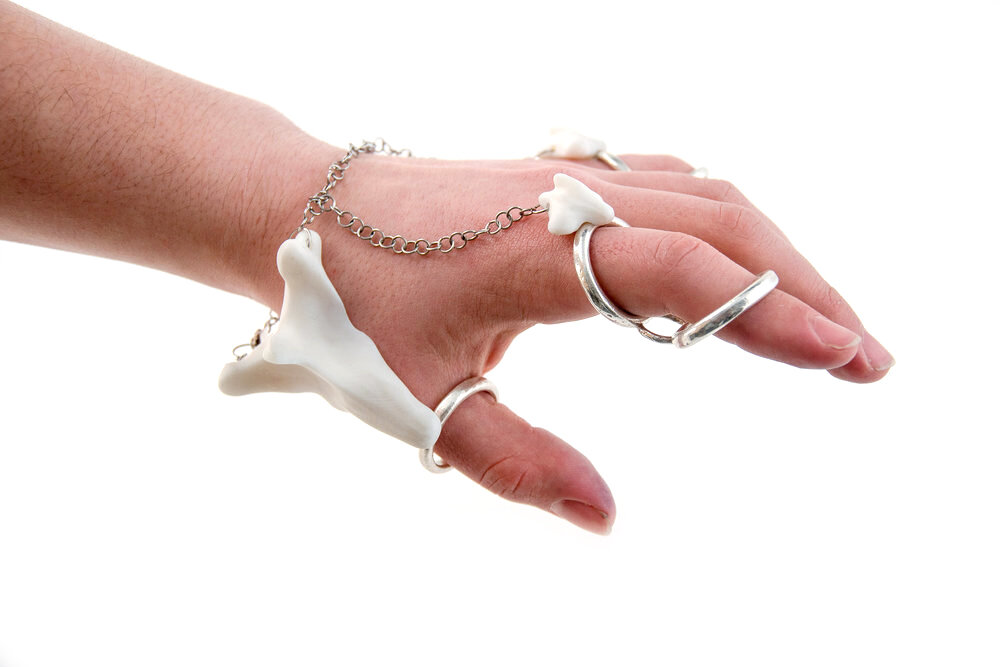 Multi-part Splint Ring2-2.jpg