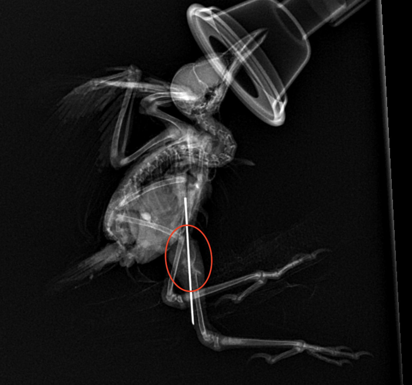 Post-Surgery X-Ray