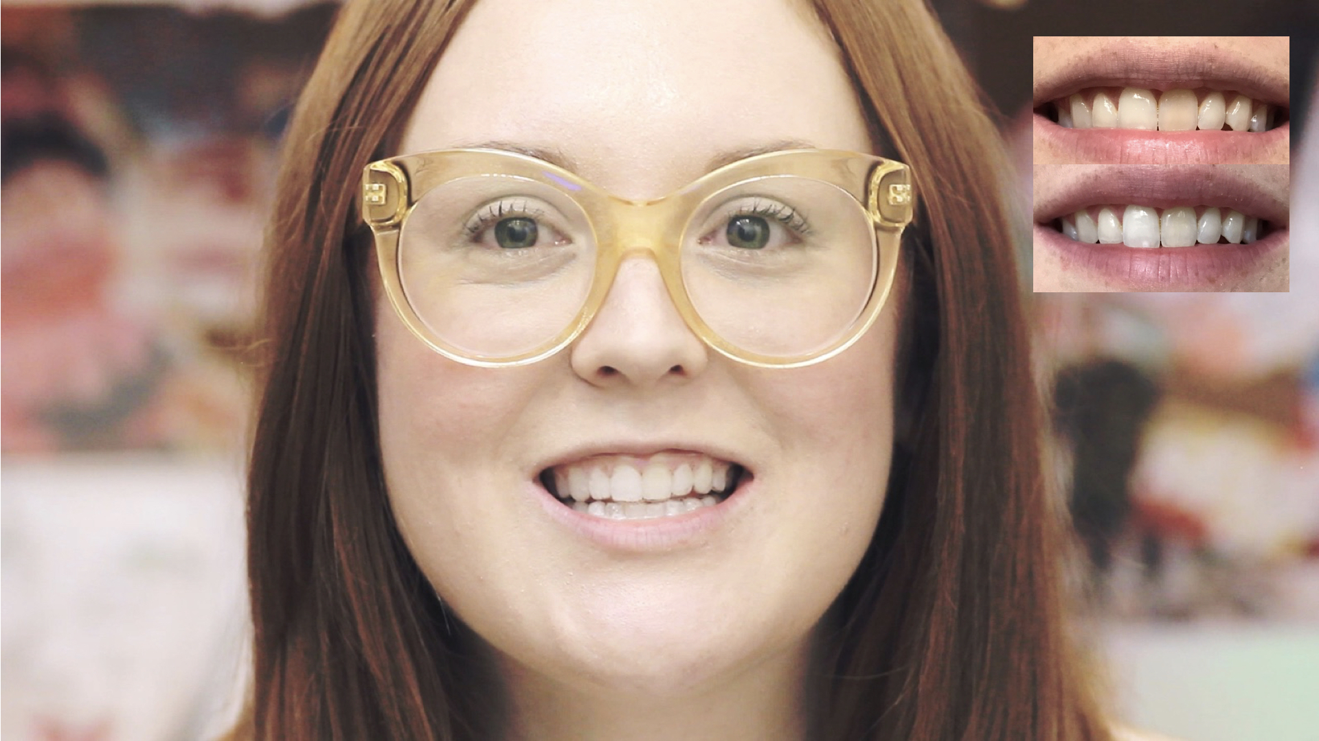 smile-brilliant-my-teeth-whitening-beauty-routine.001.jpeg