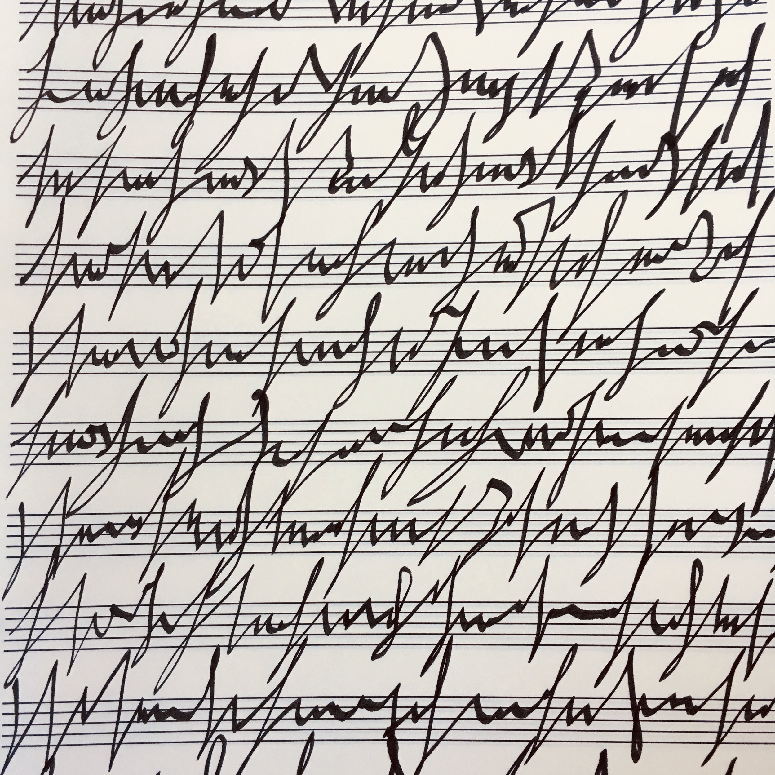 Wire Arrhythmia