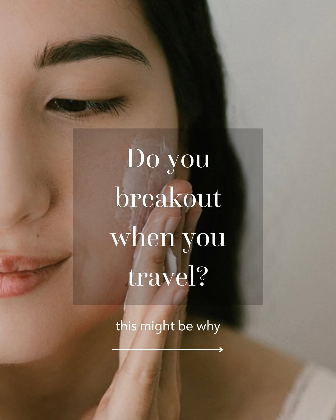 As you all know, I&rsquo;m in Japan and I&rsquo;m currently mending my skin from a breakout. I always break out when I cross time zones, especially when I go overseas. It&rsquo;s frustrating, but honestly, you&rsquo;ve got to live a little, so I&rsqu