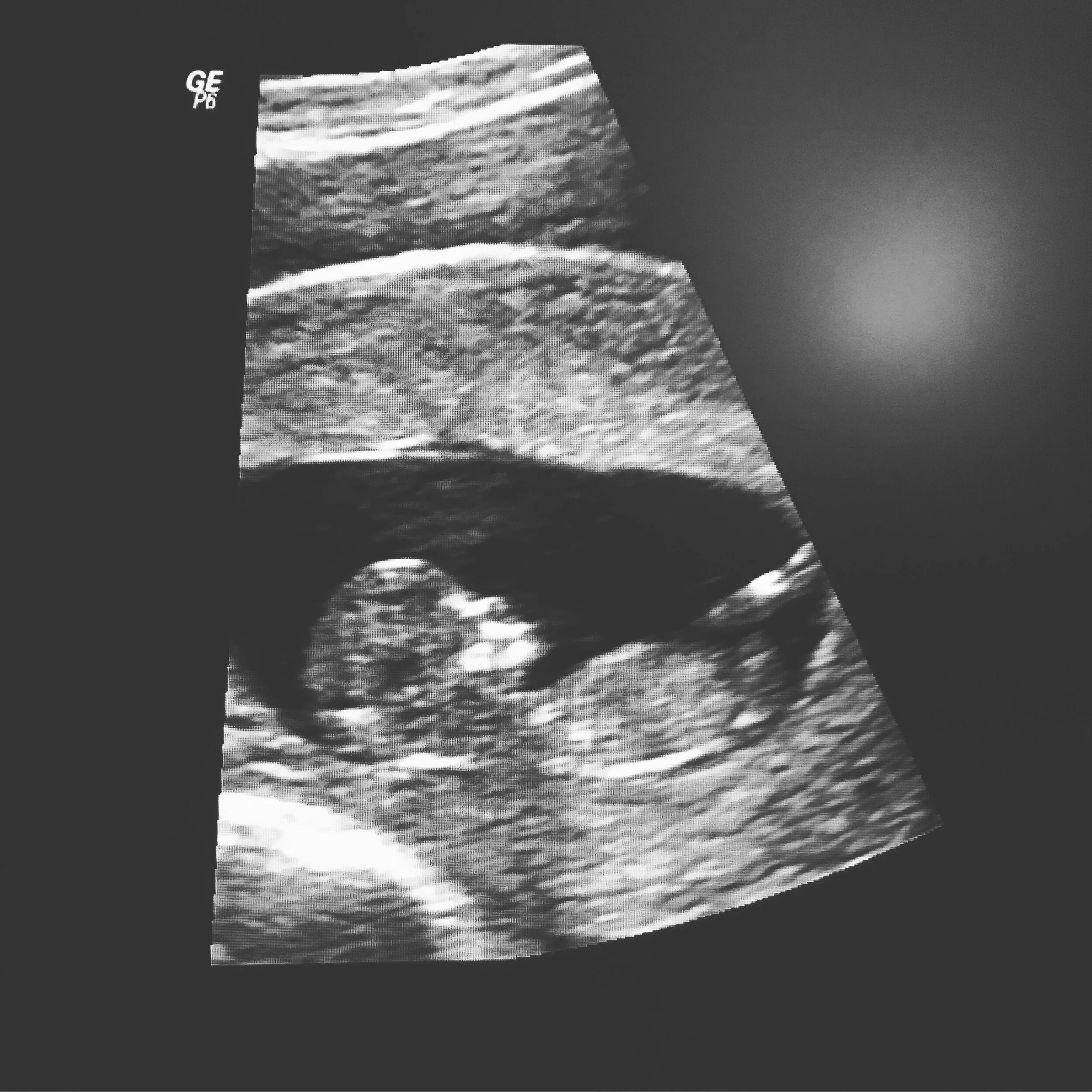 We're Pregnant!