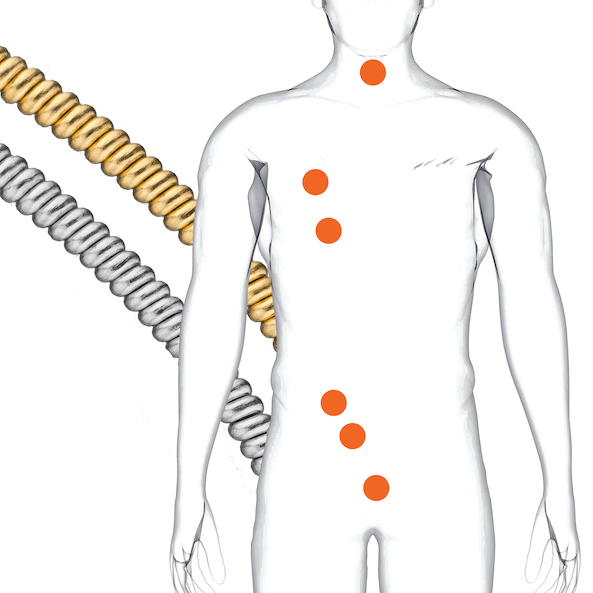Visicoil Fiducial Marker — IZI Medical