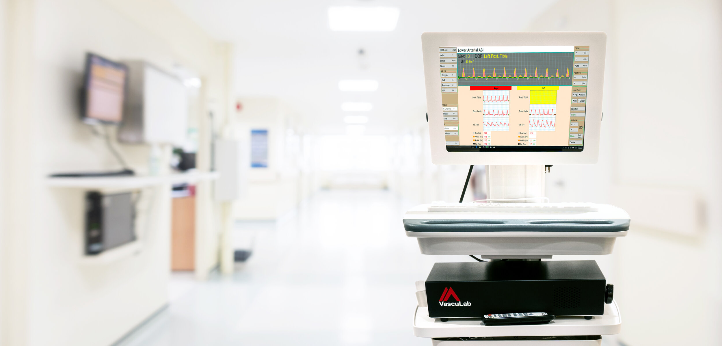 Vasculab monitor in hospital hallway