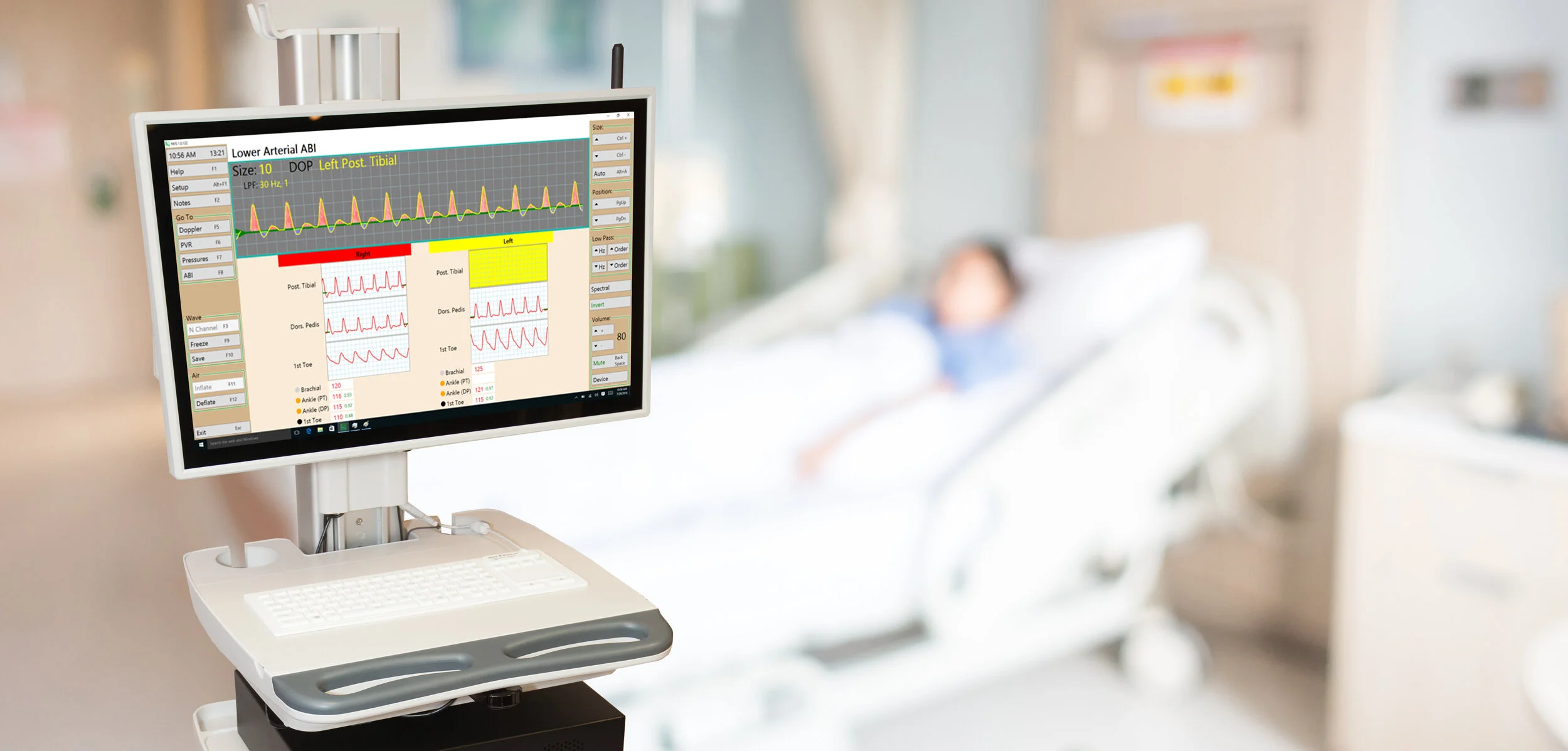 Vasculab PAD diagnostic system - monitor screen