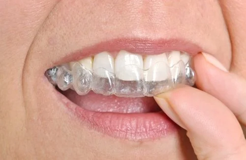 Top 8 Common Orthodontic Problems: How Orthodontics In Waterloo Can Help