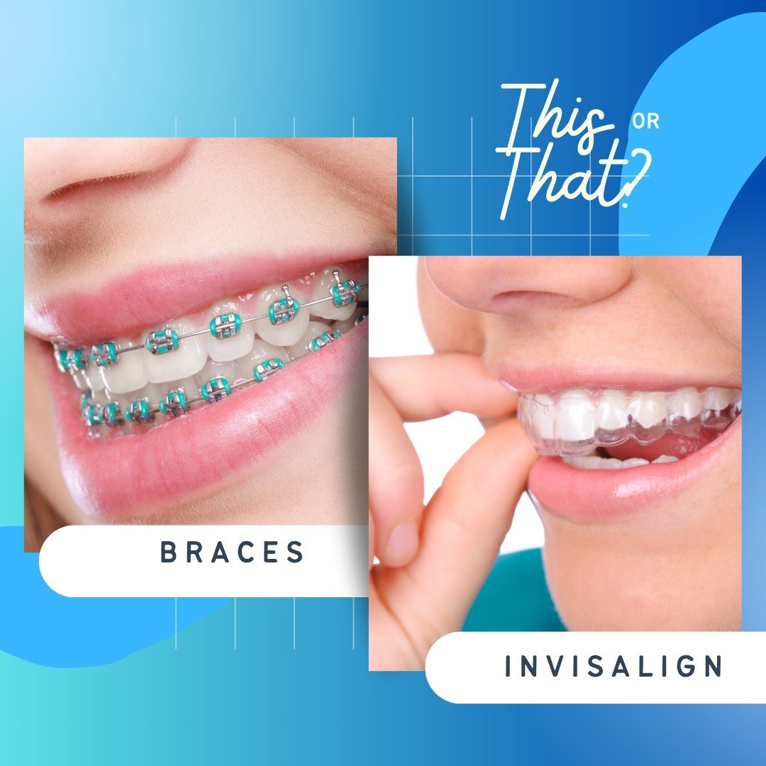 Invisalign: Straighten Your Teeth Discreetly