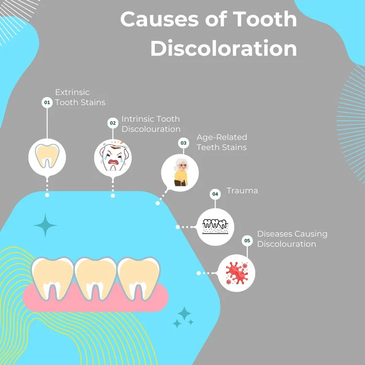 Tooth Discolouration Types, Causes, and Prevention Methods KWC Dental