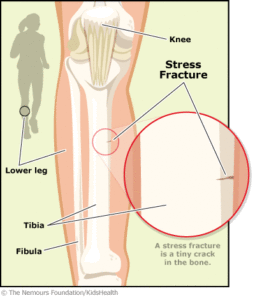 DEVELOPING THE YOUNG FEMALE ATHLETE 8 2561 image