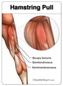 hamstring-pull-biceps-femoris-219x300.jpg
