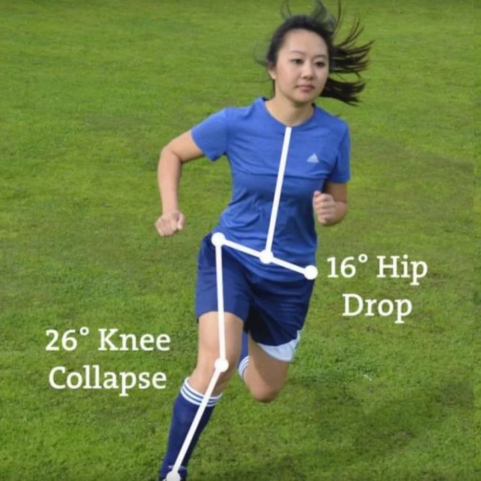 ACL-Tear-Prevention.jpg